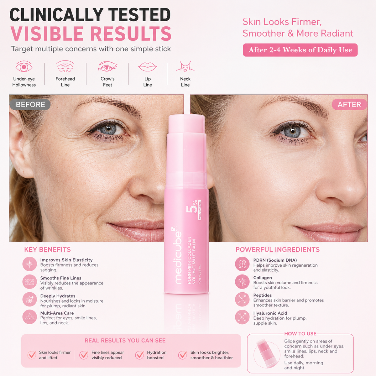 Medicube PDRN Pink Collagen Multi Balm – Firming & Wrinkle Care Stick for Youthful Skin